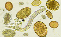 Natürliche Mittel zur unterstützenden Behandlung bei Blastocystis hominis im Darm